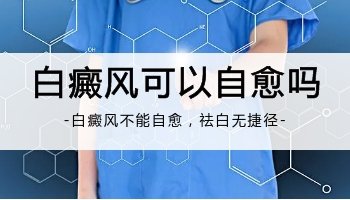 右脸一块白癜风能否通过308激光治疗？