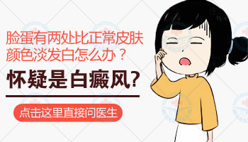 如何检查是否患了白癜风：专业指南与常见问题解答