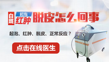 家用308光疗仪与医院308激光治疗仪的专业区别解析