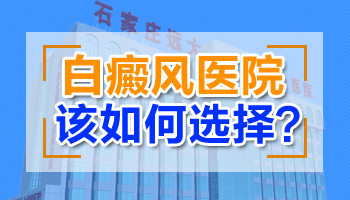 308激光治疗白癜风的收费解析