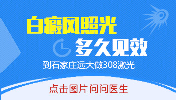 小孩白癜风照308激光治疗效果解析