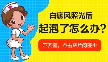 白癜风检查仪器：科技助力精准诊断