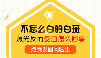 308激光治疗白癜风五次后停几天行不行？专业解析与建议