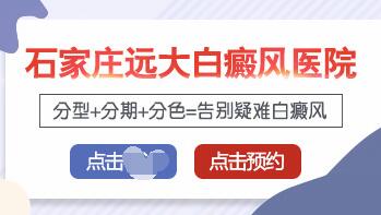 白癜风患者的必要检查项目