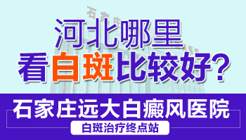 哪种类型的白癜风适合用308激光治疗