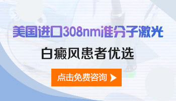 308激光治疗白癜风：多长时间照一次的专业解析