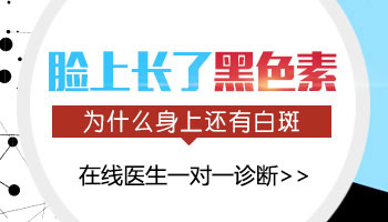 家用308仪器与医院308激光治疗白癜风效果对比分析