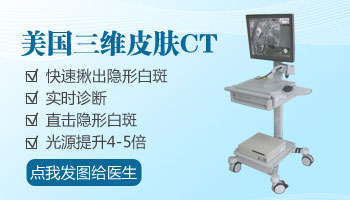 `Wood灯检查白癜风：原理、方法与重要性`