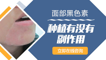 腰部白斑做CT检查的费用详解