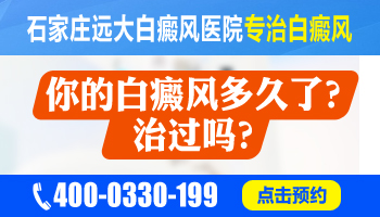 脸上白癜风激光治疗恢复周期详解