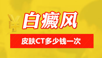 石家庄哪家医院308准分子激光治疗技术领先？