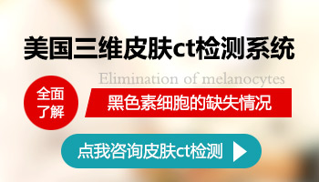 308准分子激光照射白癜风几次能见效的专业解析