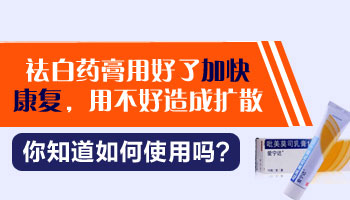 抽血可以检查白癜风吗？