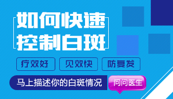 UVB光疗治疗白癜风费用及效果详解