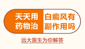 白癜风检查需要多少时间？