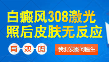 308准分子激光治疗白癜风费用详解