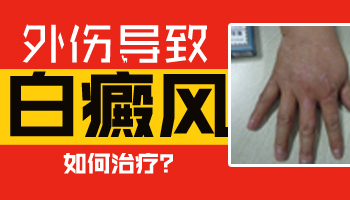 白斑处变黑：是否代表病情在好转？