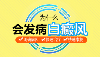 白癜风检查紫外线荧光反应呈阴性解读