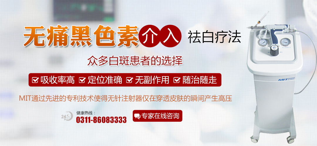 白癜风照308激光治疗的正常反应解析