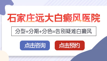 308nm准分子激光治疗白癜风疗程解析