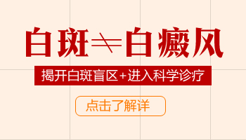 白癜风发病2个月能否接受308激光治疗