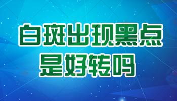 额头白癜风进行黑色素种植治疗详解