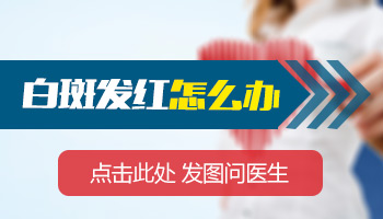 白癜风伍德灯检查：原理、准确性及注意事项