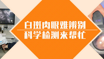 确诊散发型白癜风需进行哪些专业检查？