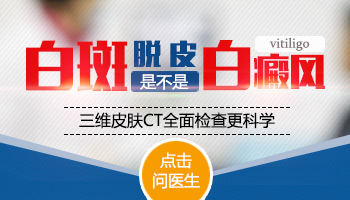 白癜风308激光治疗间隔时间的专业解析