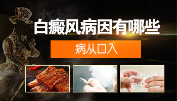 如何检查是否患有白癜风？专业指导为您解答