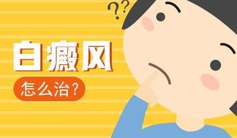 治疗白癜风是否需要检查？详细解析白癜风诊疗流程