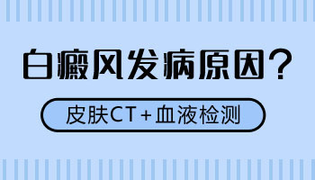 激光308治疗白癜风的不良反应及其专业分析