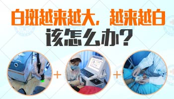 2019年308激光白斑治疗价格表及专业分析