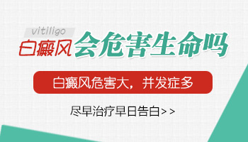 隐形的白癜风是否应接受308激光治疗的专业分析