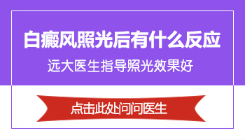 白癜风308治疗后发红现象解析：是好是坏？