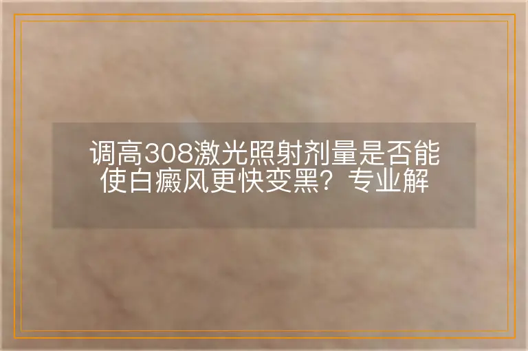 调高308激光照射剂量是否能使白癜风更快变黑？专业解析与探讨