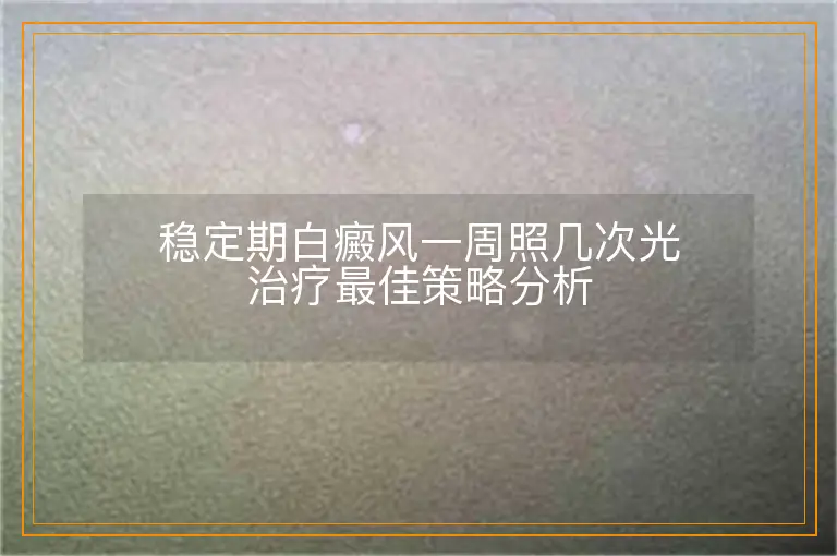 稳定期白癜风一周照几次光治疗最佳策略分析