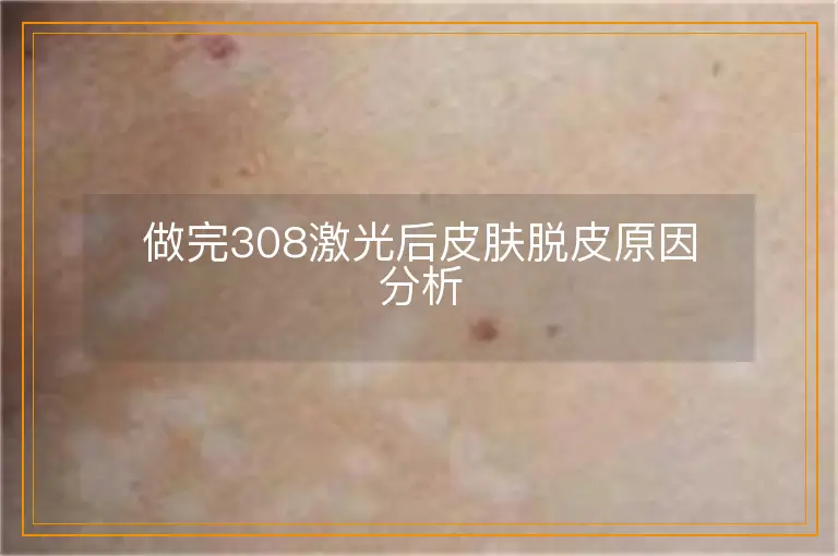 做完308激光后皮肤脱皮原因分析