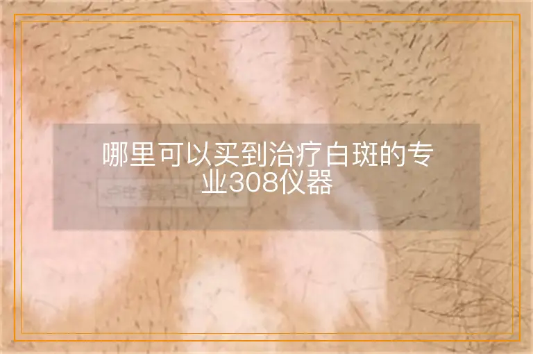 哪里可以买到治疗白斑的专业308仪器