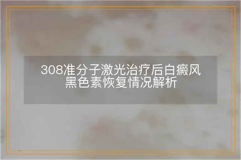 308准分子激光治疗后白癜风黑色素恢复情况解析