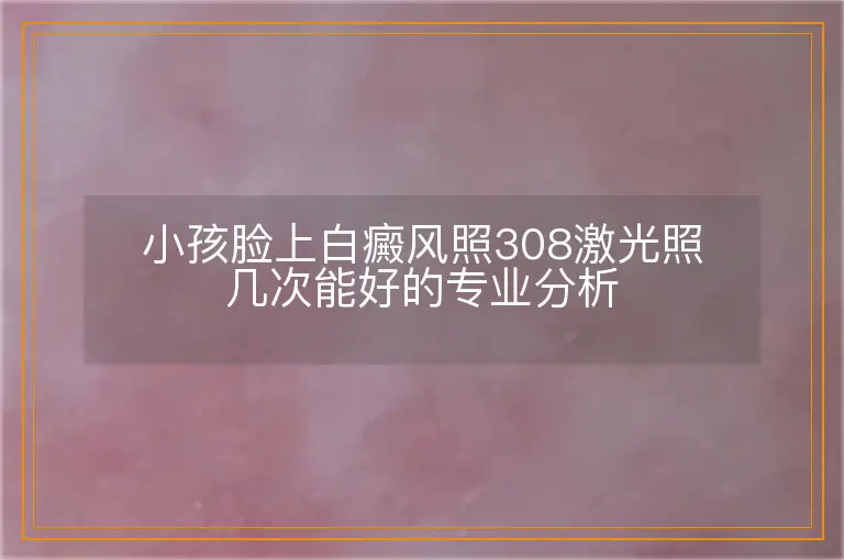 小孩脸上白癜风照308激光照几次能好的专业分析