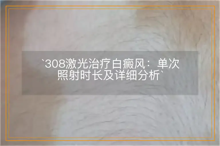 `308激光治疗白癜风：单次照射时长及详细分析`