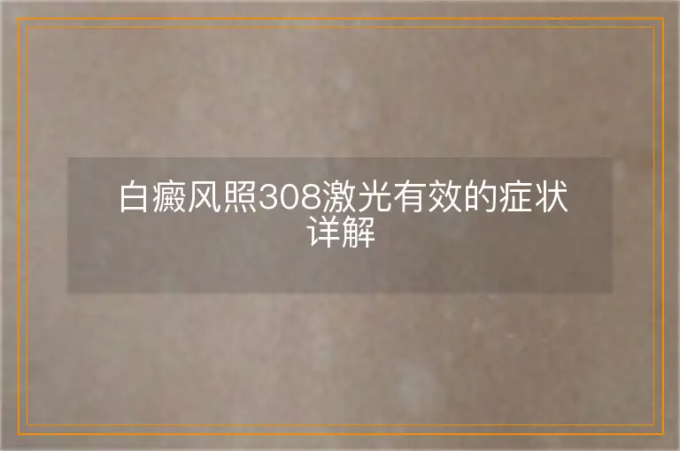 白癜风照308激光有效的症状详解