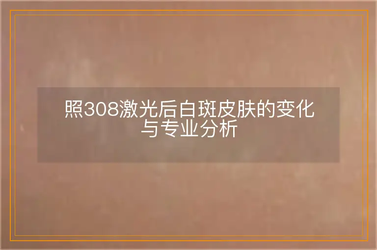 照308激光后白斑皮肤的变化与专业分析