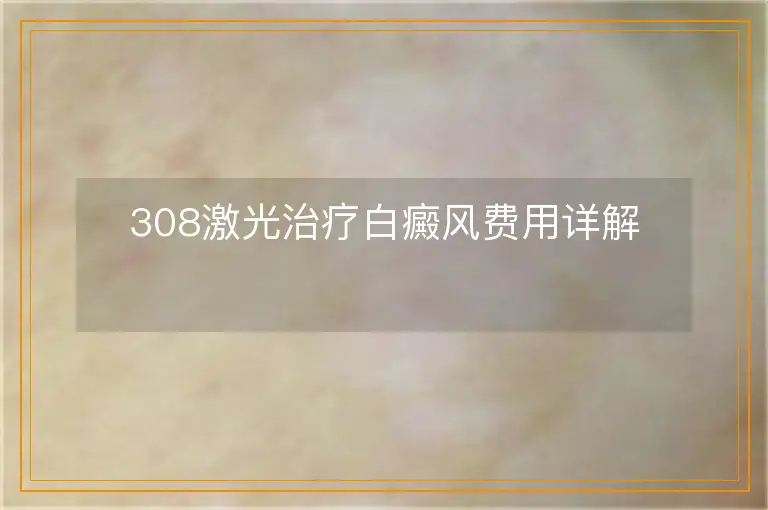 308激光治疗白癜风费用详解