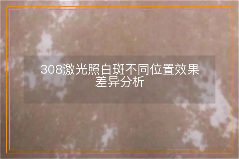 308激光照白斑不同位置效果差异分析